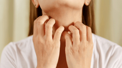 Allergen Triggers in Conventional Beauty