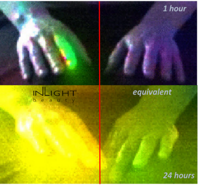 Hyperspectral study - Inlight's efficacy revealed