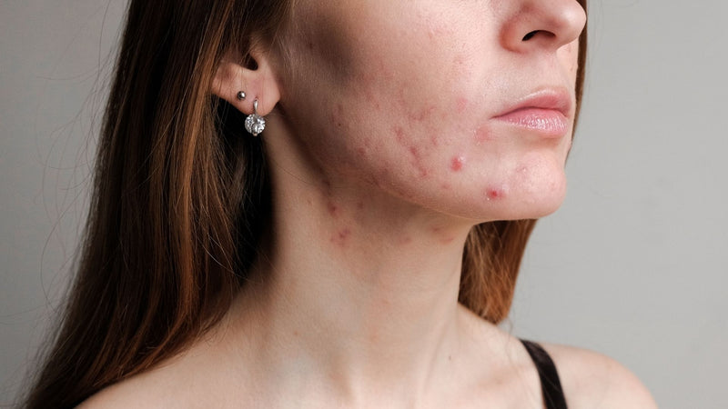 Skin Solutions