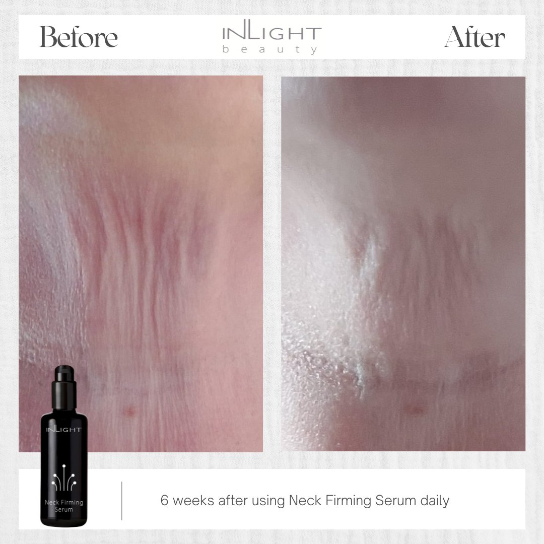 Inlight Beauty factory Neck Firming Serum